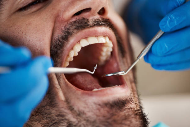 Sleep Apnea Treatment in Lewisville, TX